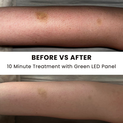 Illuminate Green V1 – Green Light Therapy Panel